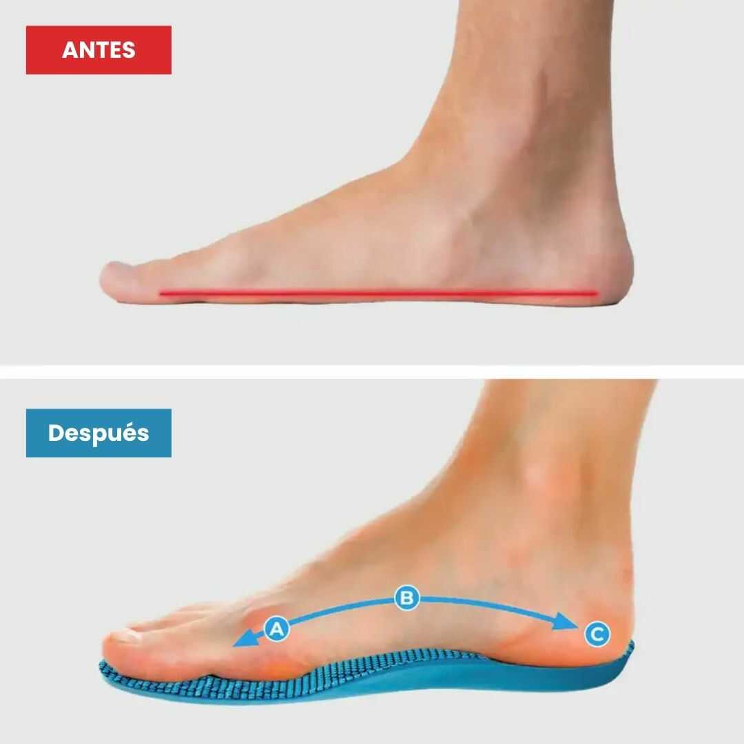 Plantillas ComfyFeet™️ - Disfruta de días sin dolor, sin tratamientos caros ni visitas al médico...